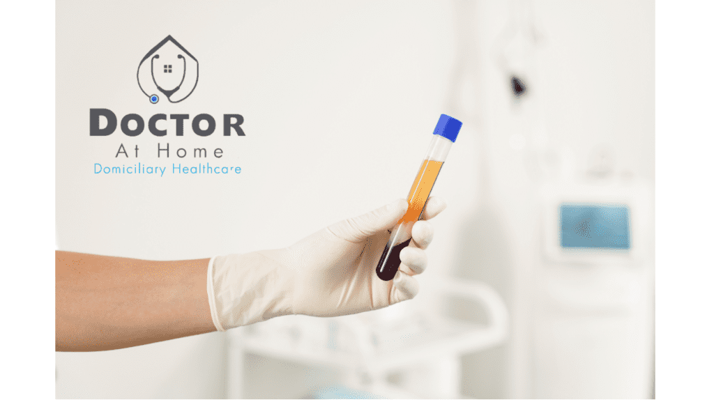 Infiltración con Plasma Rico en Plaquetas (PRP) en CDMX PRP Injection